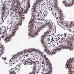 anti-RBPMS, Polyclonal, Novus Biologicals 0.1 mL | Buy Online | Novus Biologicals | Fisher Scientific